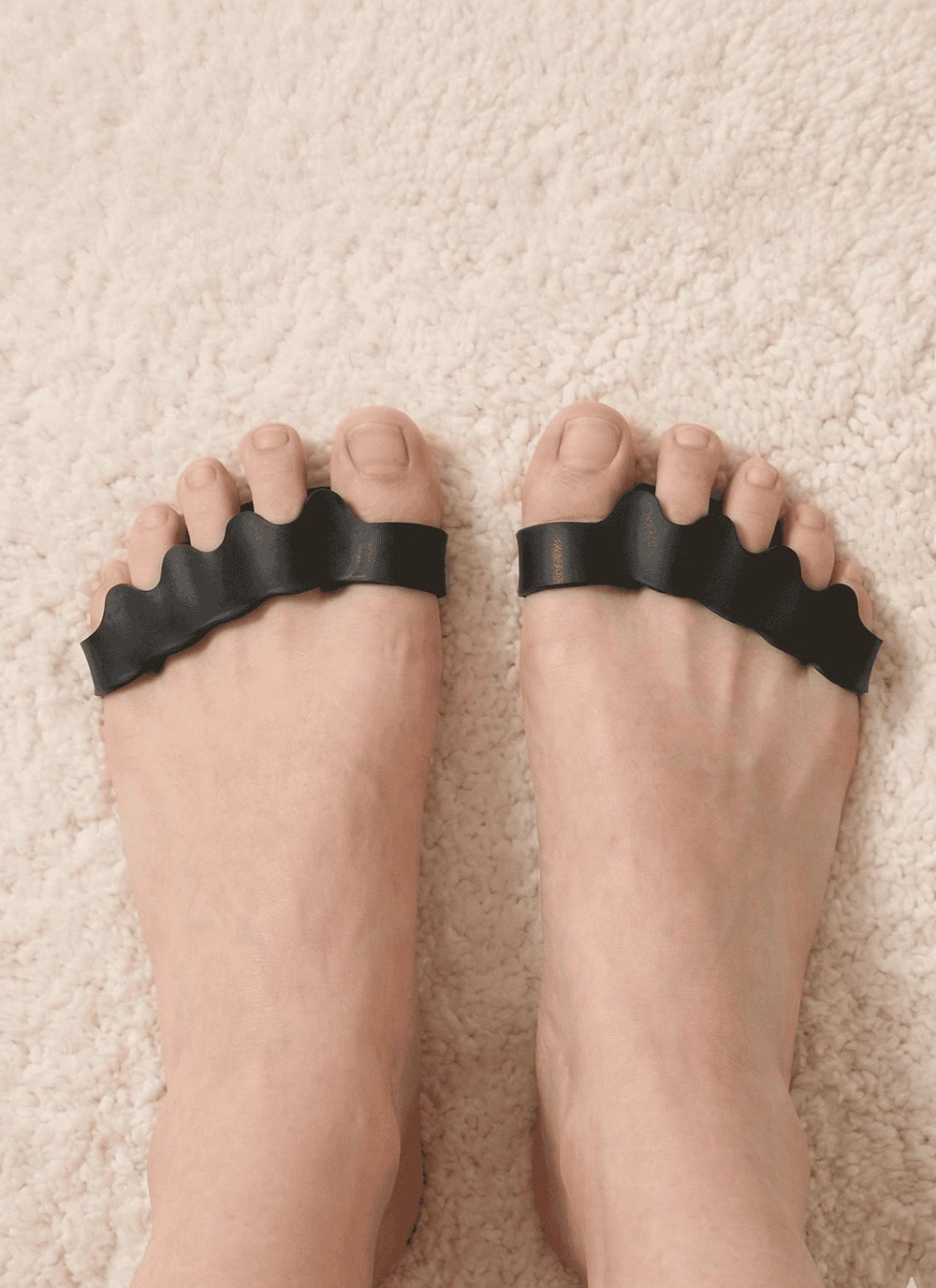 feet After using toe separators