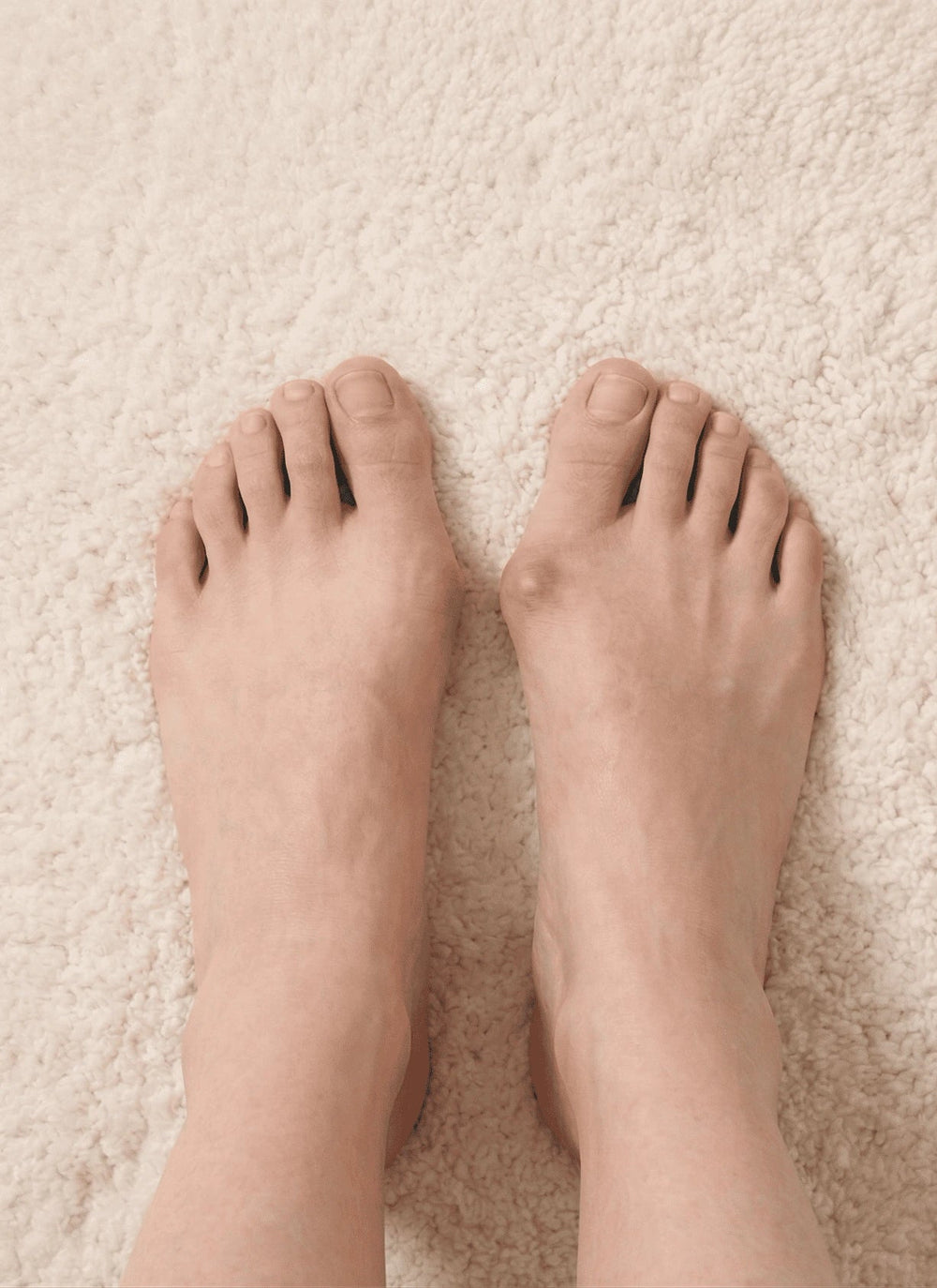 feet before using toe separator